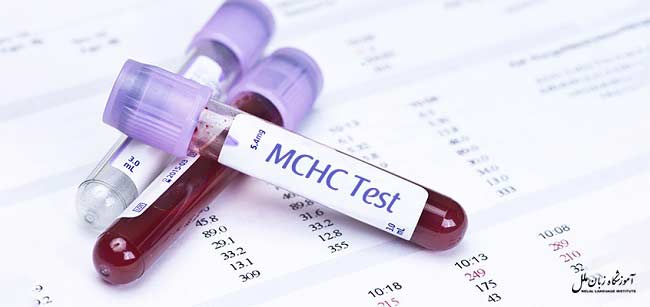 معنی علامت MCHC در آزمایش خون